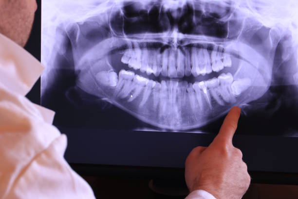 Best Emergency Cosmetic Dentistry in New Paris, IN